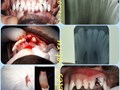 Если есть лишние зубы, которые мешают нормальному смыканию челюстей, то их нужно удалять. Много зубов так же плохо, как и мало.