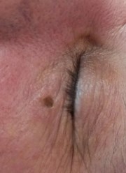 Фото компании ООО Центр Удаления Новообразований Кожи 1