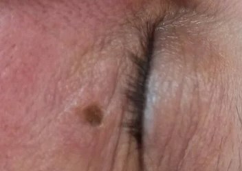 Фото компании ООО Центр Удаления Новообразований Кожи 1