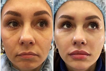 Фото компании ООО Салон красоты The Self 15