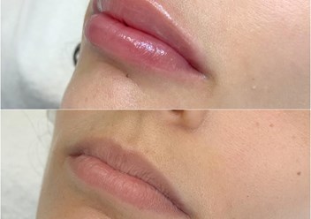 Фото компании ООО Тони Линк 1