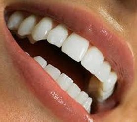 гигиеническая чистка зубов системой аэр флоу и полностью безопастное отбеливание без нагрева и ультрафиолета. http://denterum.ru/otbelivanie-zubov Самара стоматология