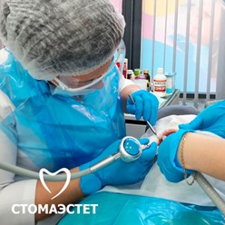 Чистка зубов в стоматологии СтомаЭстет