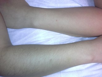 Шугаринг рук