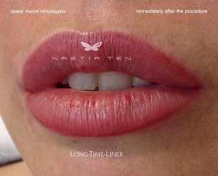 Фото компании  Студия перманентного макияжа "Nastia Ten" 3