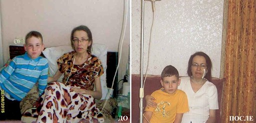 Малых Людмила, 42 года, диагноз: хроническая болезнь почек...