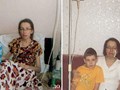 Малых Людмила, 42 года, диагноз: хроническая болезнь почек...