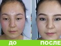 Фото компании ООО Клиника пластической и косметологической хирургии "Сагынбаева" 1