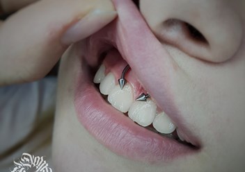 пирсинг смайл лесозаводск