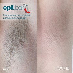 Фото компании ООО Epil bar 10