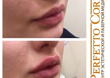 Фото компании ООО Центр эстетической и лазерной медицины "Perfetto Corpo" 2