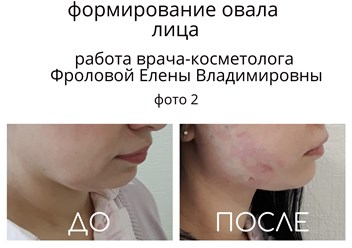 Фото компании ООО Клиника экспертной косметологии "ВОЛНА" 3