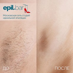 Фото компании ООО Epil bar 21