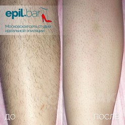 Фото компании ООО Epil bar 19