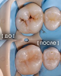 Фото компании  Экспертная стоматология «Элисан» 20
