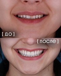 Фото компании  Экспертная стоматология «Элисан» 22