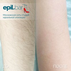 Фото компании ООО Epil bar 9