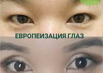 Фото компании ООО Клиника пластической и косметологической хирургии "Сагынбаева" 5