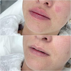 Фото компании ООО Тони Линк 4