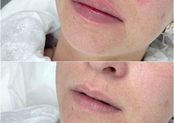 Фото компании ООО Тони Линк 4