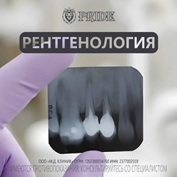 Рентген зубов в Курганинске