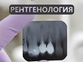 Рентген зубов в Курганинске