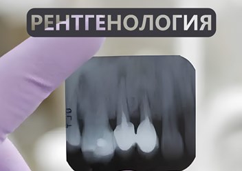 Рентген зубов в Курганинске