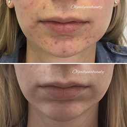 Фото компании  OlgailyinaBeauty 8