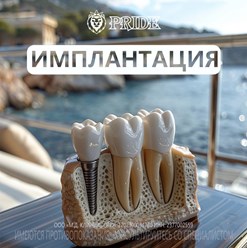 Имплантация зубов по выгодным ценам