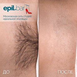 Фото компании ООО Epil bar 13