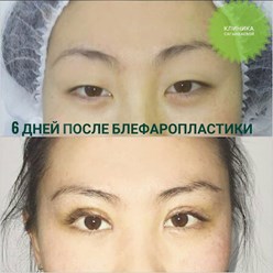 Фото компании ООО Клиника пластической и косметологической хирургии "Сагынбаева" 6