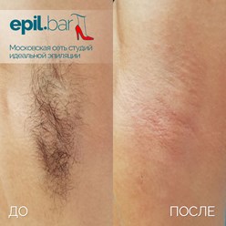 Фото компании ООО Epil bar 14