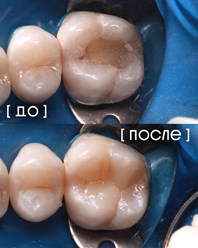 Фото компании  Экспертная стоматология «Элисан» 25