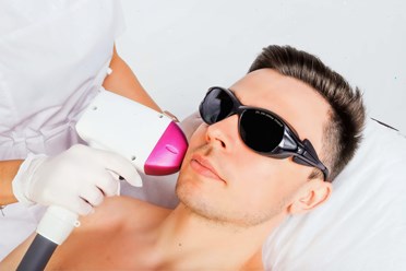 Лазерная эпиляция для мужчин