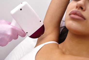 Лазерная эпиляция в Москве