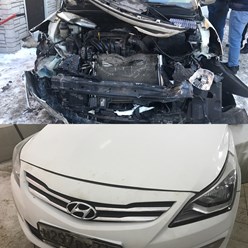 Восстановление после ДТП