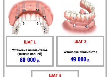 Акция17