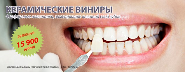 Акция в Робидент - керимические виниры