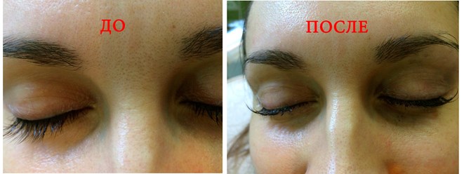 Кератиновое ламинирование ресниц Yumi Lashes