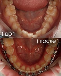 Фото компании  Экспертная стоматология «Элисан» 21