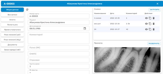 Карта зубов