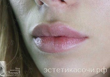 Фото компании  Центр косметологии "ЭстетикА" 1