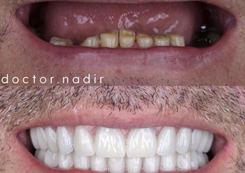 Результаты работы