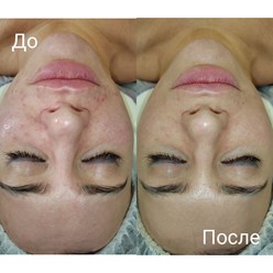 Фото компании ООО Epil 19