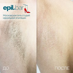 Фото компании ООО Epil bar 11