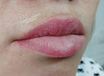 Зажившая работа, перед коррекцией.
Очень удобно в жизни. 👍
Не нужно переживать, что сейчас с лицом... 😊
Готовы подать себе красоту?
Ваша Светлана Яковенко
#нюдовыегубкиОренбург #липлайтгубыоренбург