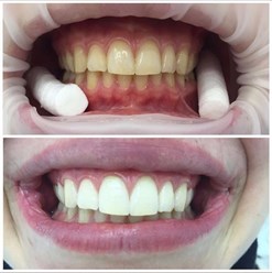 Сет 60 минут. Осветление 12-16 тонов