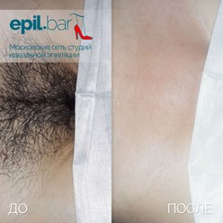 Фото компании ООО Epil bar 4