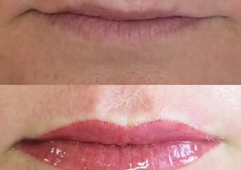 Перманентный макияж губ до/после