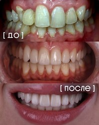 Фото компании  Экспертная стоматология «Элисан» 19